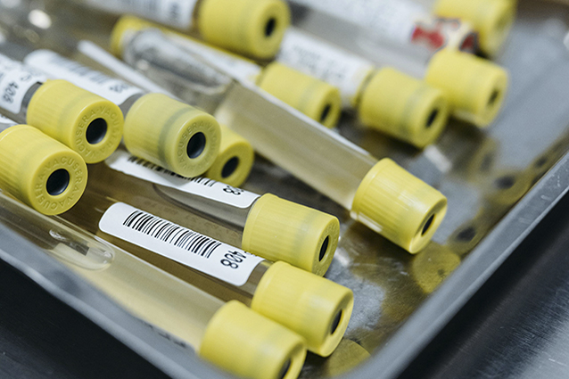 How to solve the problem of label misalignment on the labeling machine